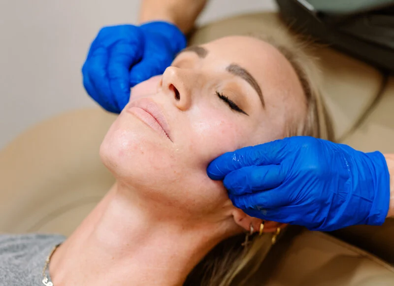 Facials and peels